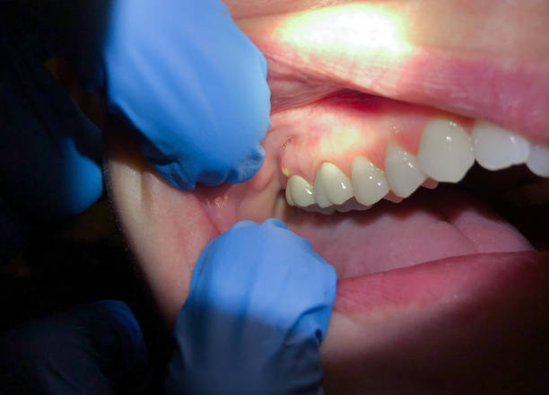 Best Emergency Dental Surgery in China Lake Acres, CA